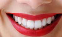 4 نصائح لتحصلين على ابتسامة بيضاء من المنزل