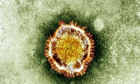 320 ألف فيروس جديد يهدد البشرية