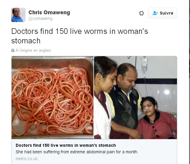 استخراج 150 دودة حيّة من بطن شابة هندية